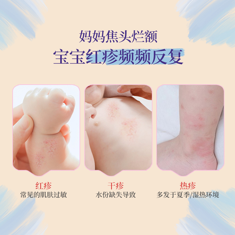加州宝宝燕麦面霜儿童婴幼儿专用金盏花润肤乳夏季新生儿保湿滋润