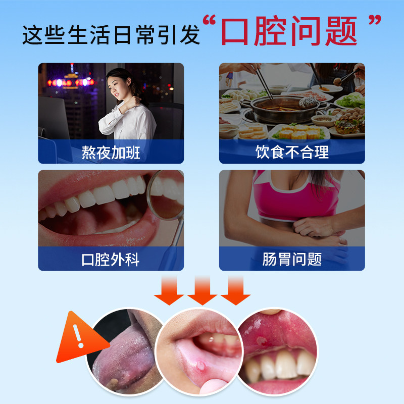 牙得安一点灵送涂药棒口腔不适溃烂起泡上火非凉茶铺抑菌液一点零