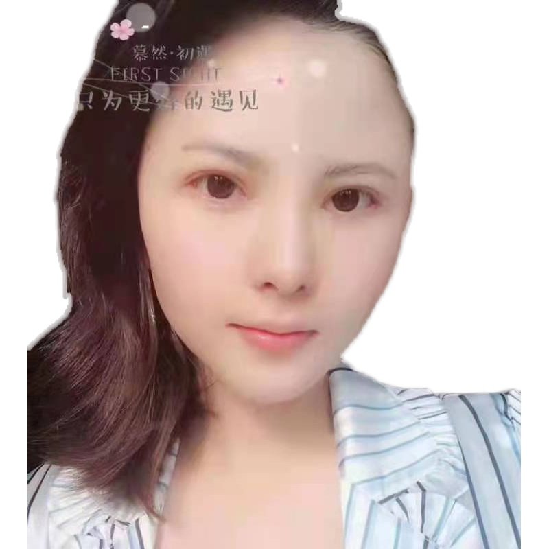 团购正品慕然初遇面膜玻尿酸补水修护白膜神经酰胺净肌修复黑膜 - 图3