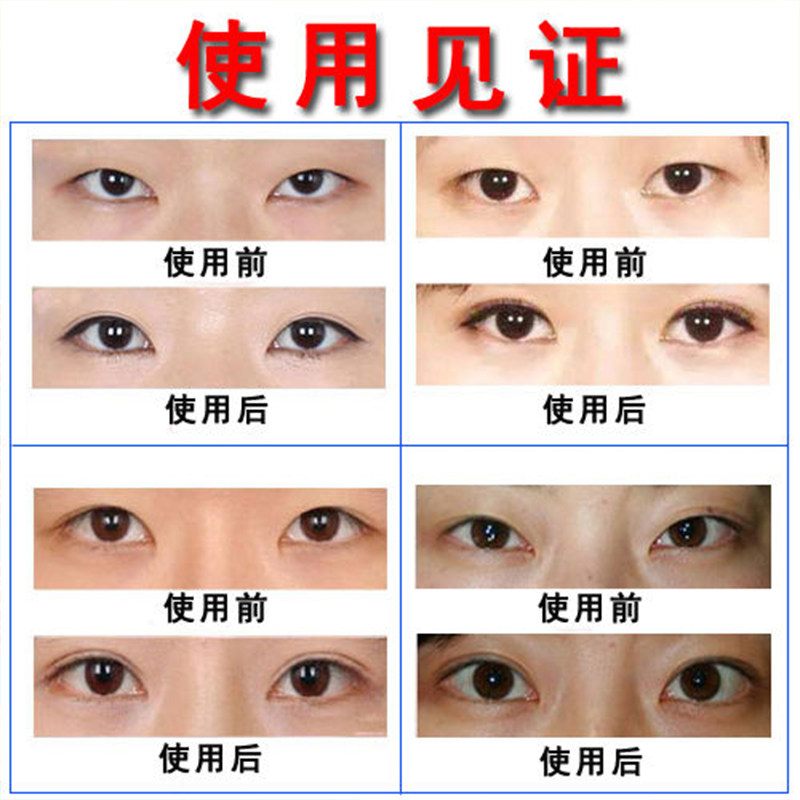 扩眼精油女开眼角精华液单眼皮变双眼皮神器小眼睛变大去肿泡眼男