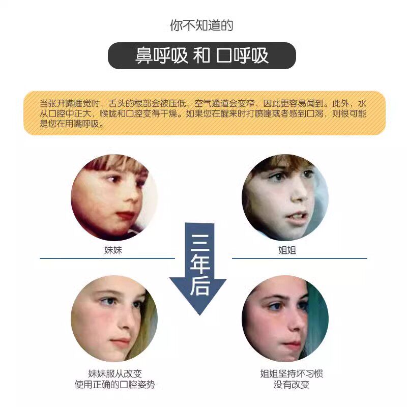 腺样体肥大面容儿童张嘴呼吸矫正器唇肌训练睡觉防张嘴口呼吸嘴凸