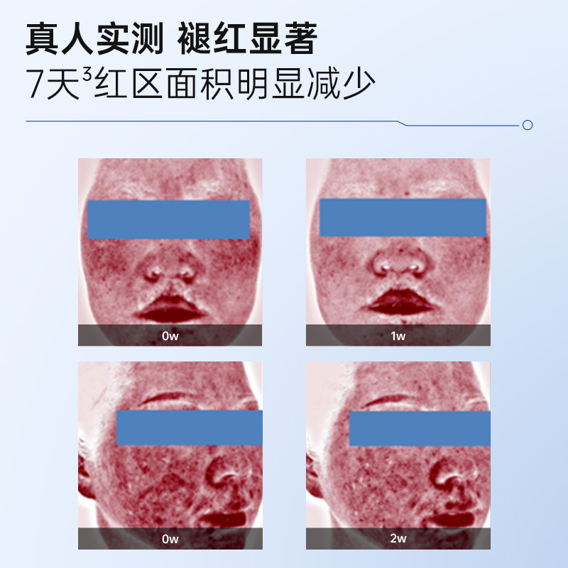 【新品首发】绽媄娅医用皮肤修护水乳术后护理械字号补水敷料新款