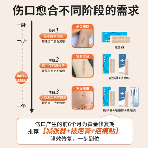 Медицинское натяжение типа