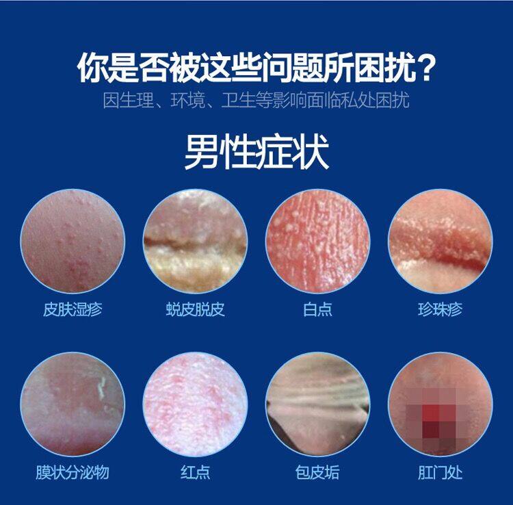 复方高猛酸钾溶液女士妇科男士洗液 精医馆保健用品私处护理