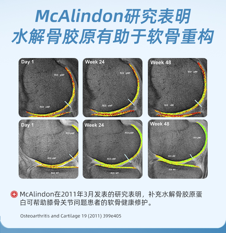 Epaplus骨胶原蛋白粉西班牙骨粉进口蛋白质粉运动健身营养粉332g - 图0