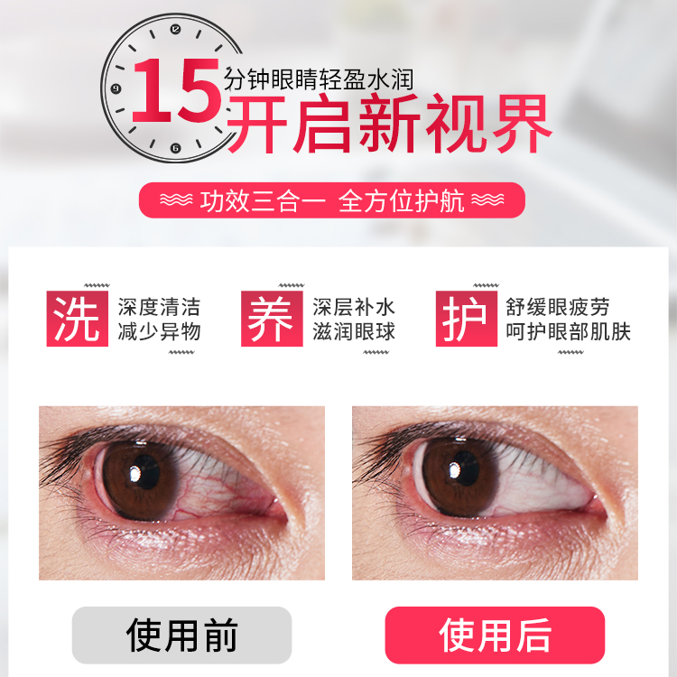 美莉思源旗舰店洗眼液清洁眼部护理液学生清洗眼睛水眼疲劳洗眼缓解眼干涩护理液2