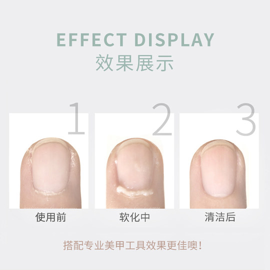 XIX美甲软化剂专业修手指甲边缘去角质死皮剪推套装工具高端全套