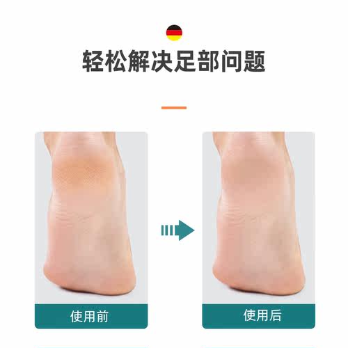 MR.GREEN双面搓脚板进口不锈钢磨脚器干湿两用脚锉嫩足工具 - 图1