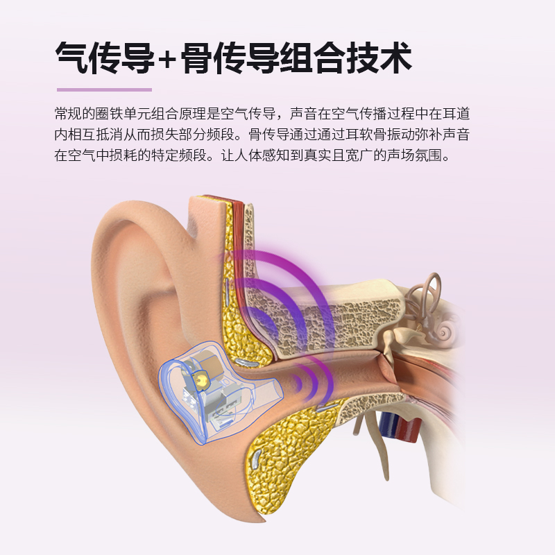 BGVP 幻影感温变色 声扬静电圈铁骨传导八单元混合入耳式有线耳机 - 图0