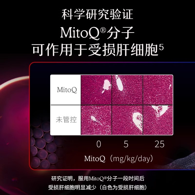 【组合装】MitoQ经典奶蓟组合奶蓟草辅酶q10熬夜加班喝酒保健品