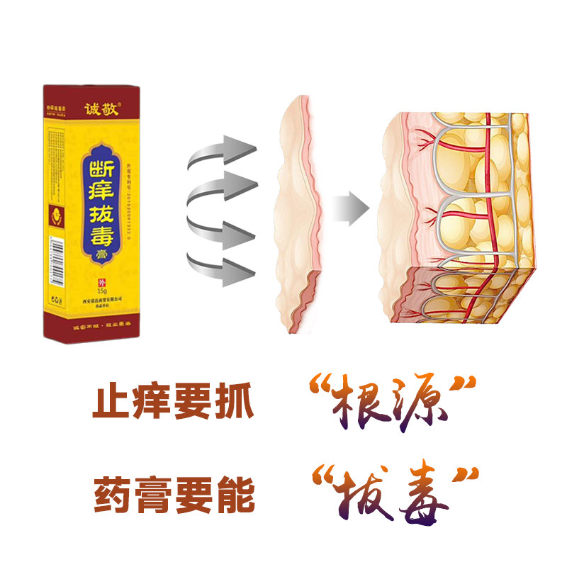 诚敬断痒拔毒膏全身皮肤过敏止痒膏 七草堂保健用品皮肤消毒护理（消）