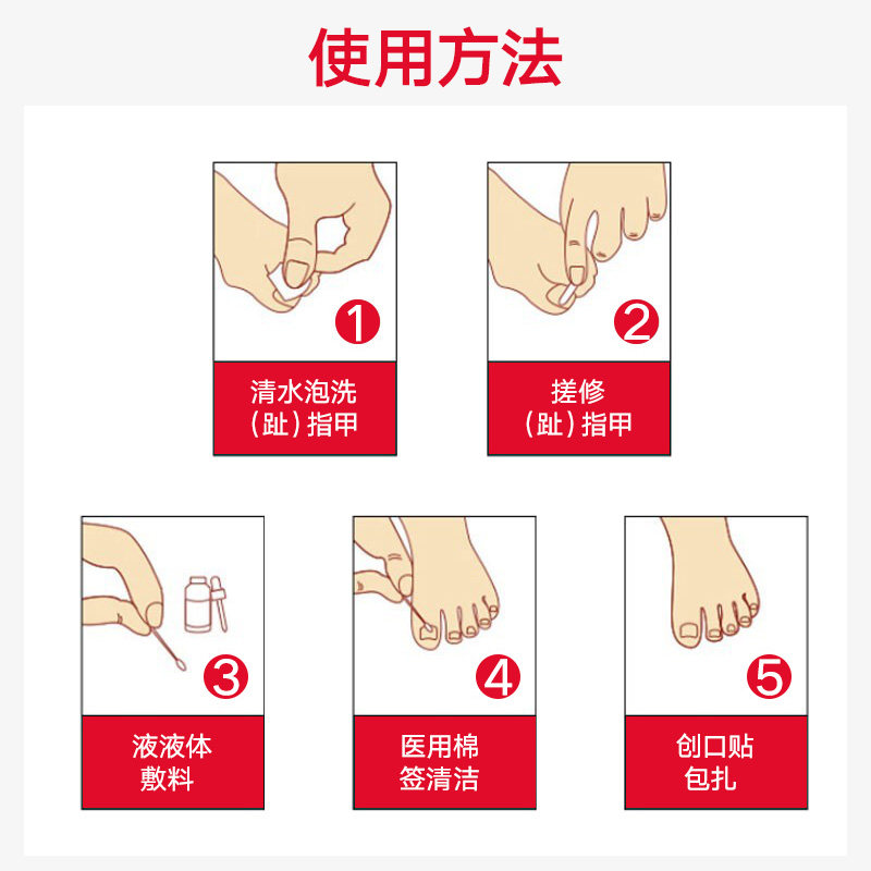 修正灰指甲治疗灰甲正品创口贴 大黄蜂保健品保健理疗