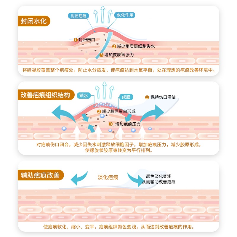希睿达硅凝胶去疤膏美国日本进口原料疤痕膏医用修护硅酮祛疤膏-图0