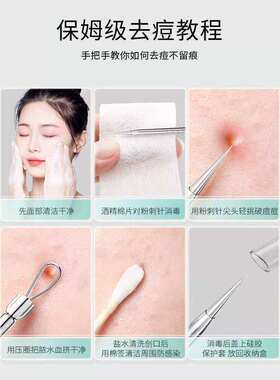 【赠送收纳盒】美容店专用细胞夹美容针粉刺夹粉刺针黑头痘痘针QQ