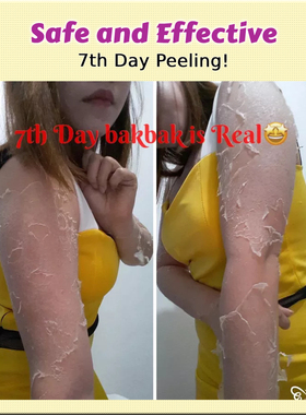 SCDPeelinglotionwhitening