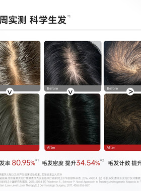 半岛生发帽81颗红光防脱密发