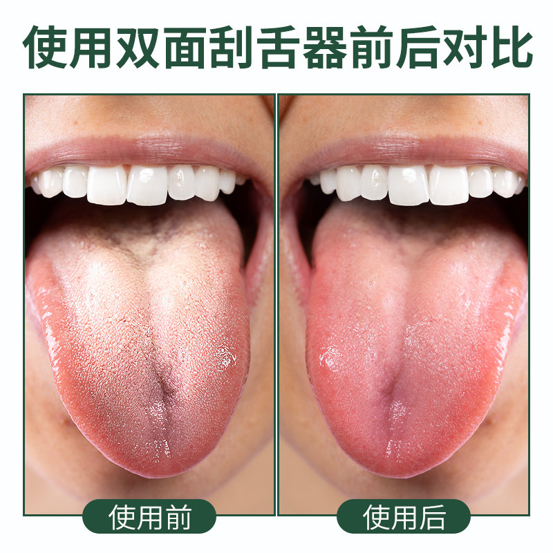 图 4