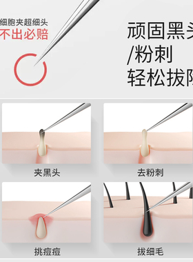 超细粉刺针细胞夹套装镊子去黑头刮闭口神器挑挤痘祛痘针工具套装