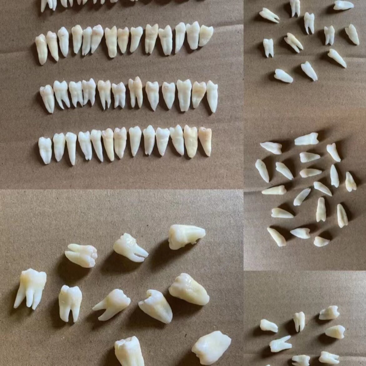 学生考试专用真牙离体牙口腔技能考试前磨牙开髓学生实验