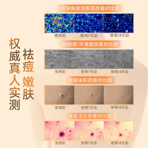 cibio2希蓓欧果酸沐浴露身体乳去角质滋润补水保湿嫩肤留香持久 - 图0
