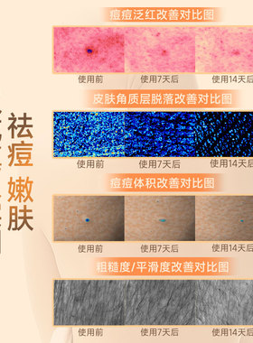 cibio2希蓓欧果酸沐浴露420g*2