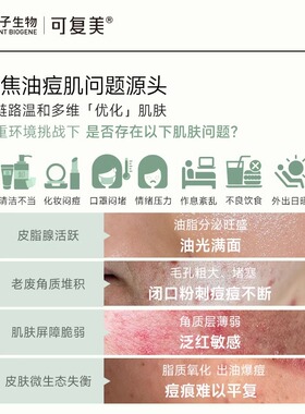 可复美净痘次抛淡化痘印24支