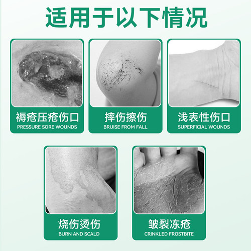 妥能银离子消毒凝胶褥压疮破损皮肤伤口烧烫伤护理创面敷料安信牌 - 图0