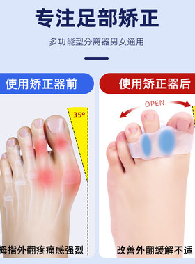 脚趾矫正器硅胶拇指外翻分指套大脚趾头纠正分离男女防磨固定神器