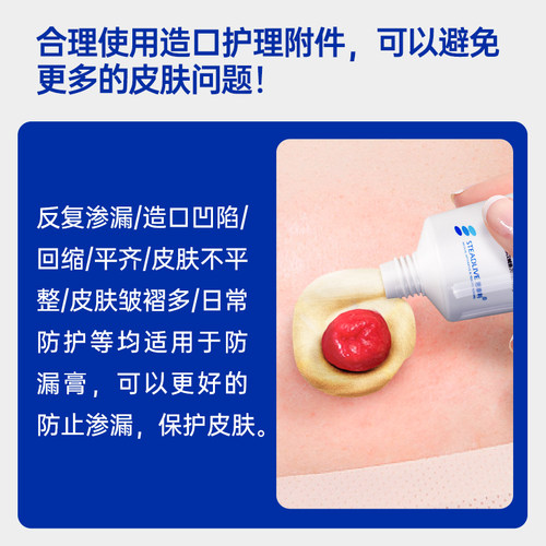 造口防漏膏7012造口袋防漏胶造瘘口防漏贴环造口护理用品附件60g - 图1
