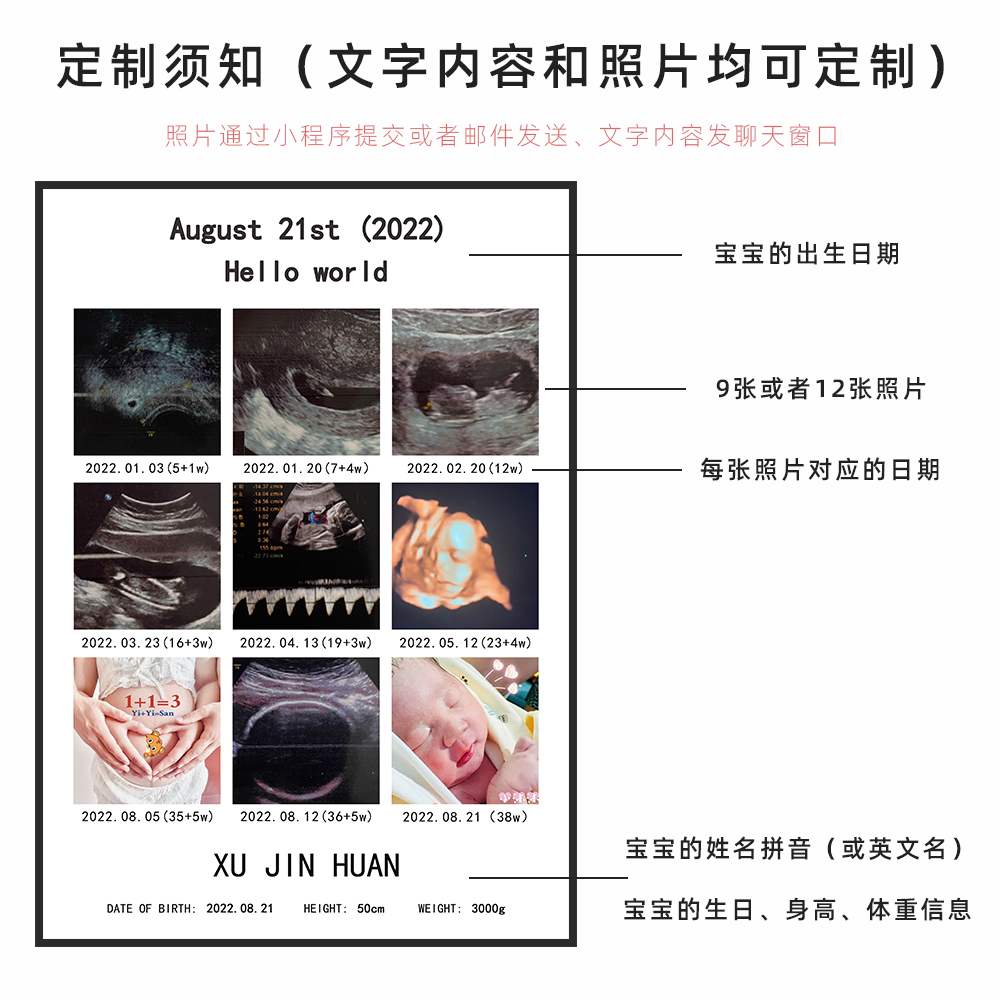 孕期b超纪念相框定制 宝宝婴儿三维彩超产检照片组合九宫格打印 - 图2