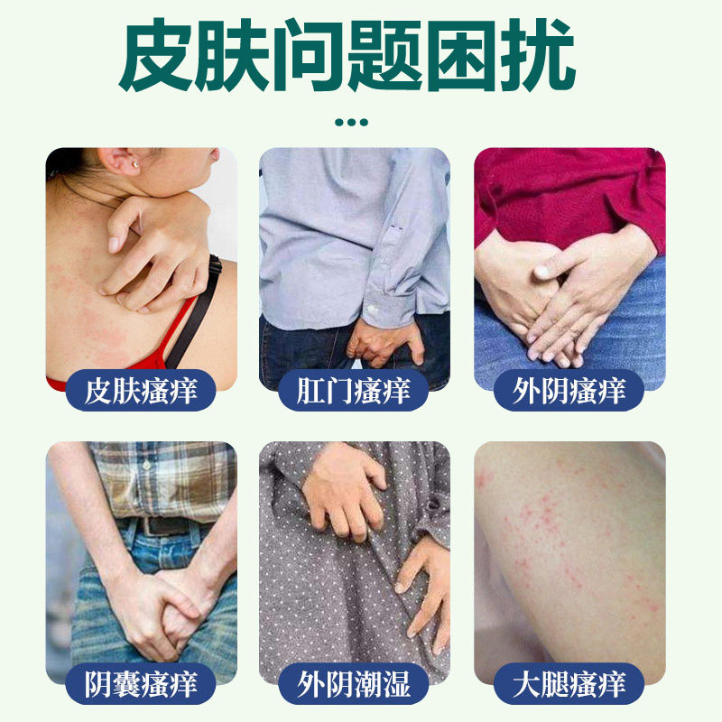 修正湿疹膏医用皮肤凝胶止痒男去女私处外阴阴囊湿痒根肛门瘙痒JW_虎窝淘