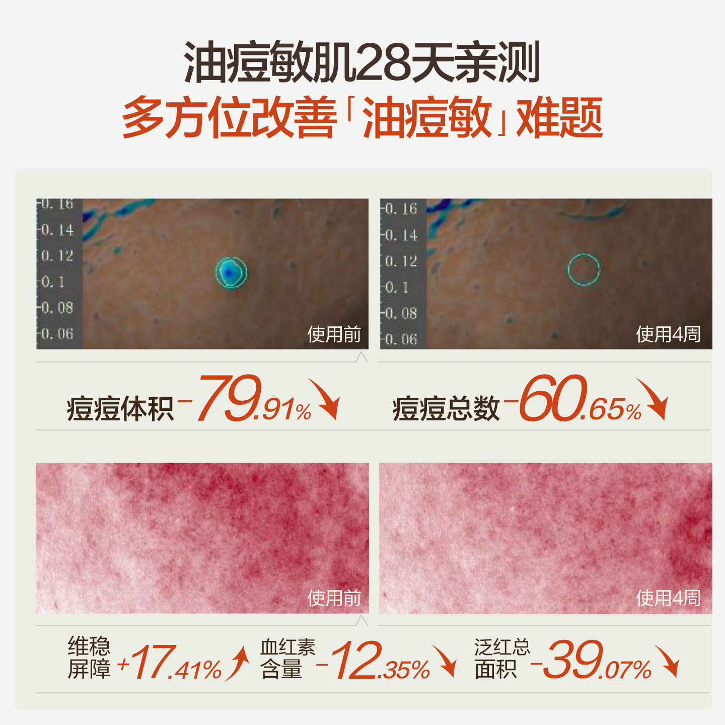 【汪苏泷同款】HBN磨皮精华乳液控油祛痘平闭口修护油皮敏感肌,淘宝优惠券,粉丝福利购,淘宝优惠卷