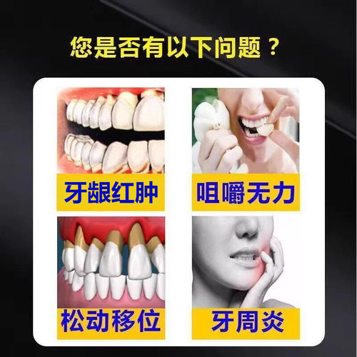 云南白药牙膏官方旗舰店正品品牌治I牙周口腔牙龈炎消止炎痛YB - 图0