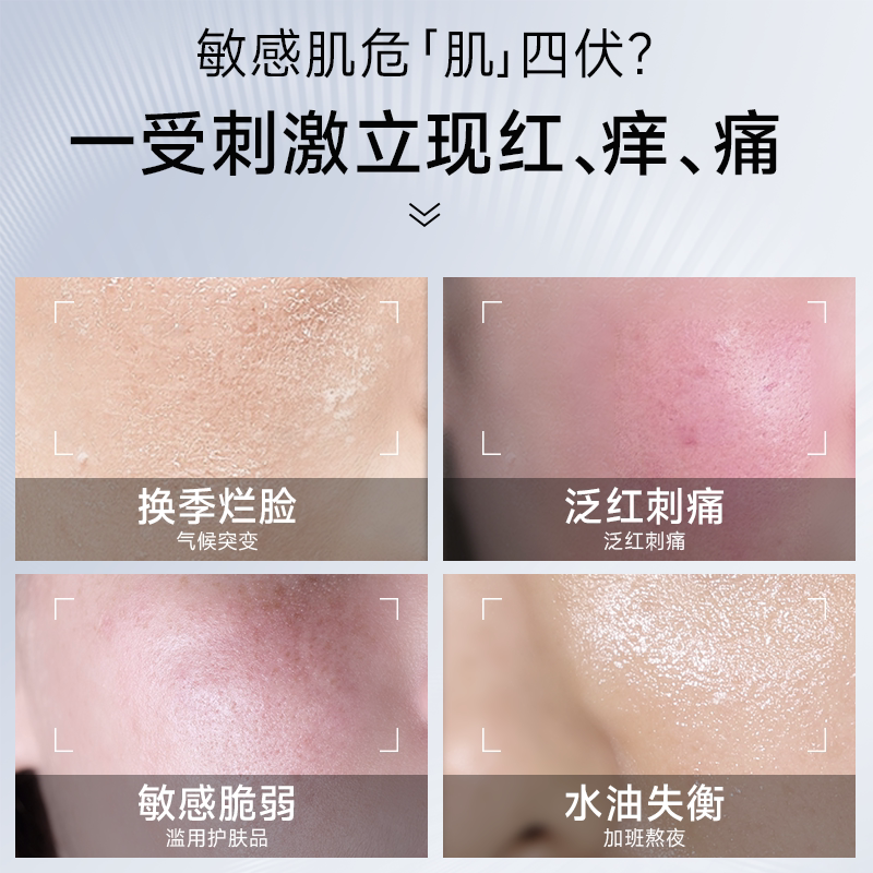 皮宝舒缓修护霜敏感肌皮肤屏障清爽控油保湿褪红精华乳液面霜官方