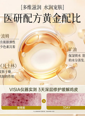 佰束止痒润肤露专攻秋冬季滋润保湿缓解干燥修护身体乳官方正品