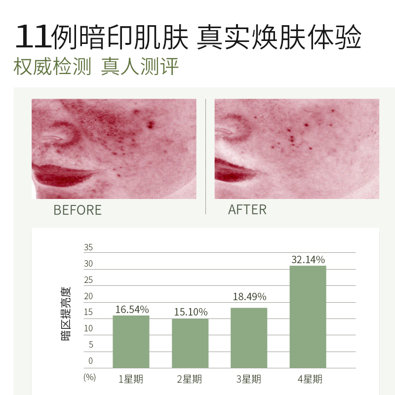 左艺滤镜精华液油90ml面部vc淡化红褐黑痘印祛黄提亮收缩毛孔补水 - 图2