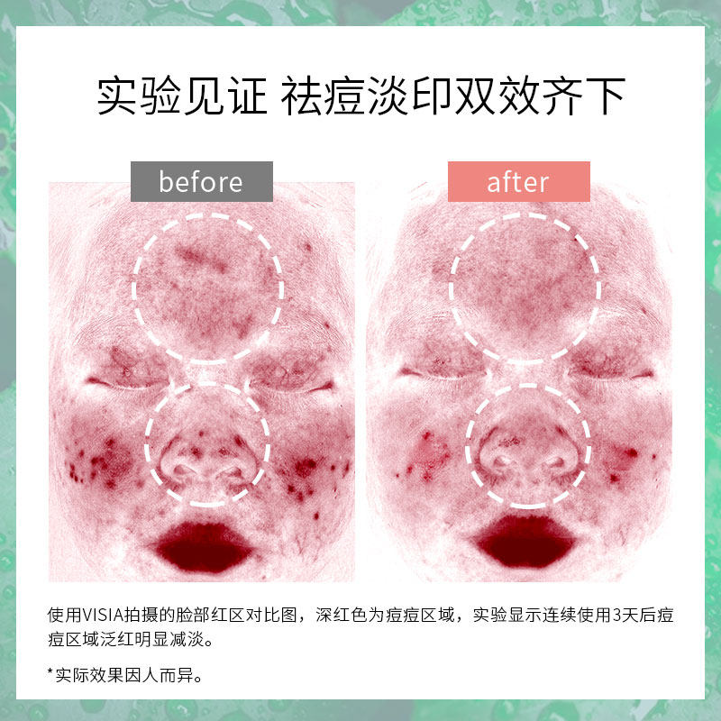 yinnocent因嫩生积雪草苷精华液 因嫩生液态精华