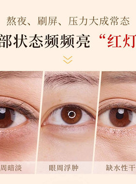 润凰黄芪保湿眼霜抗皱紧致淡化眼周细纹眼纹抗官方旗舰店正品衰老