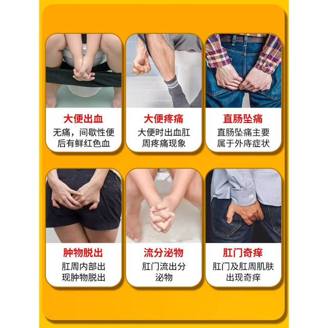 Japanese hemorrhoid cream hemorrhoid root genuine product to remove flesh balls, stop bleeding and break hemorrhoids, internal hemorrhoids, external hemorrhoids, anal fissure and anal fistula artifact