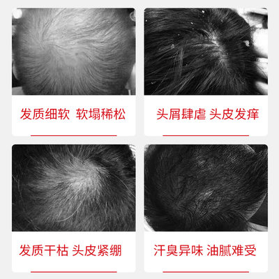 日本进口joju防脱发洗发水生发育发产后防掉发 虎窝淘