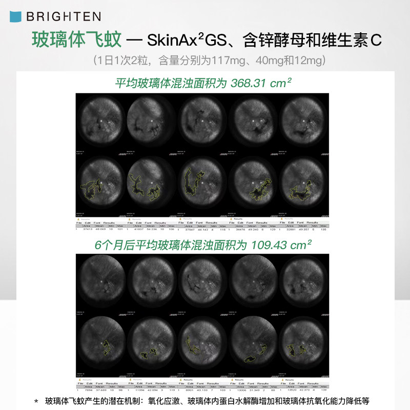 日本brighten干眼飞蚊视疲劳越橘 Brighten海外越橘/蓝莓提取物
