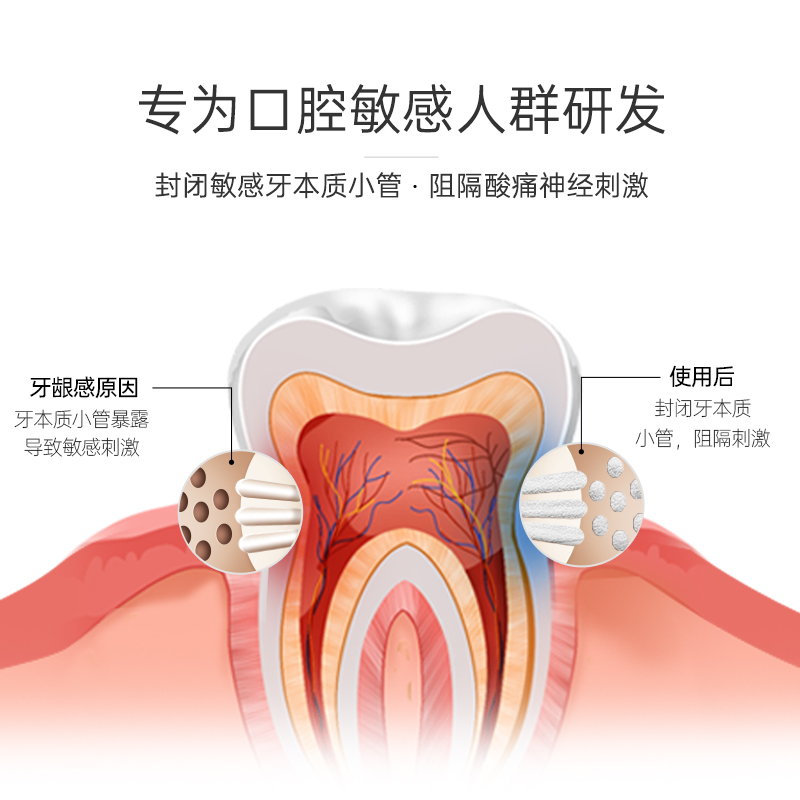 冰泉脱敏牙膏抗过敏清洁口腔护理牙龈牙齿冷热敏感专用男女专用 - 图2