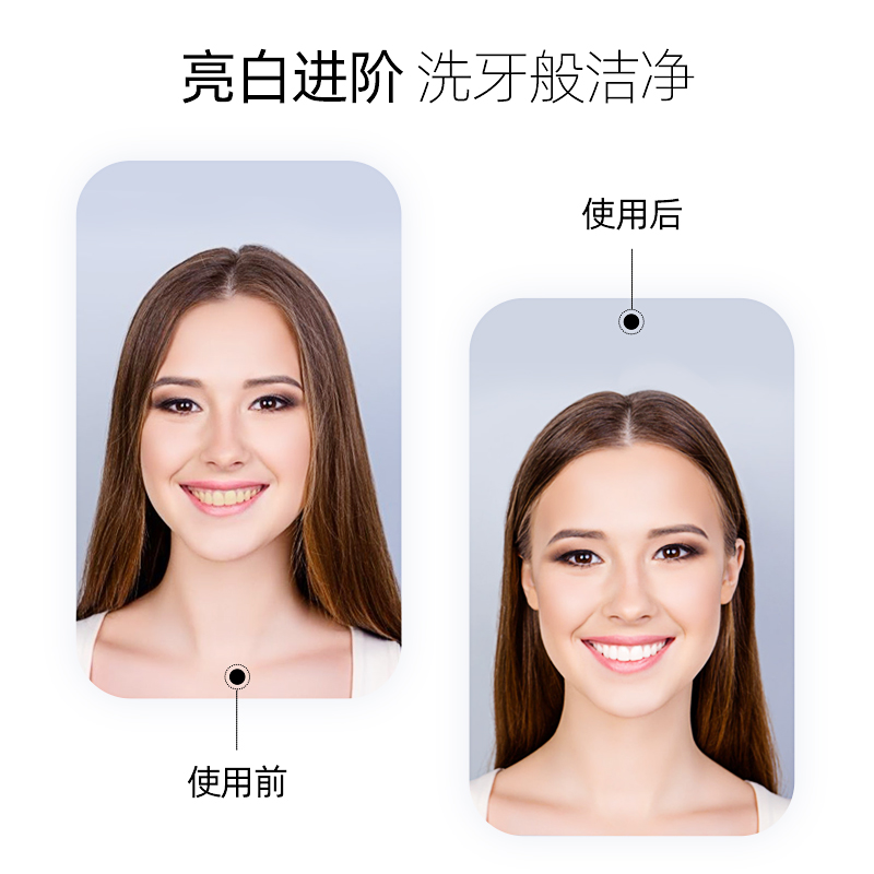 冰泉旗舰店冰泉 樱花炫白洁牙粉洗牙去黄白牙齿神器洗白速傚亮白牙白去黄牙0