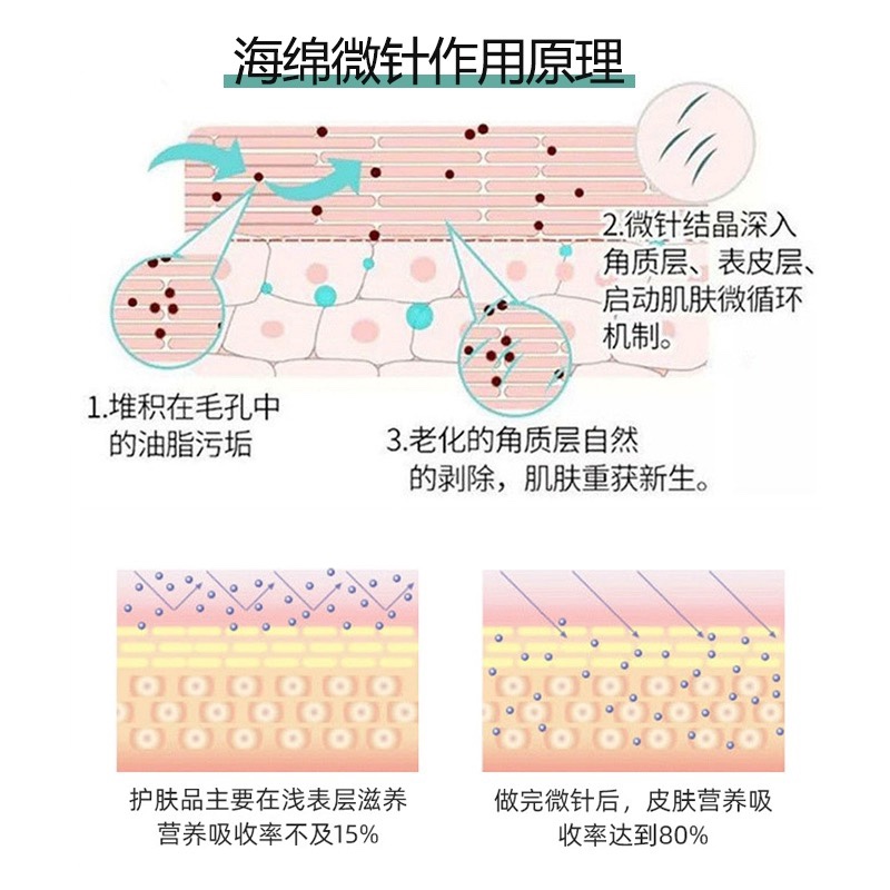 【海绵微针】深层清洁毛孔，改善包包肌肤，促进吸收-图1