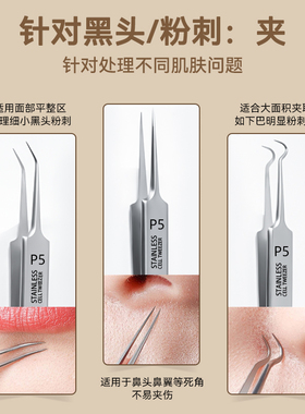 paston细胞夹黑头超细闭口粉刺针