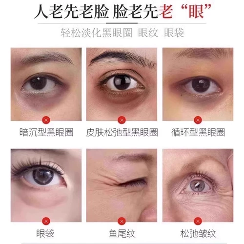 Мужской осветляющий крем для глаз от мешков под глазами, против темных кругов под глазами, против морщин