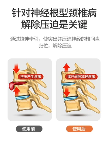 Yonghui шейки матки тяги домохозяйства по коррекции.