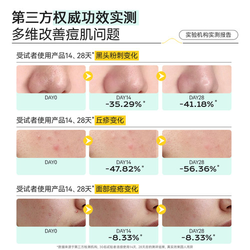 俏诺薇舒颜净护祛痘膏三支装痘印痘坑芦荟凝胶保湿淡化痘印俏诺微 - 图1