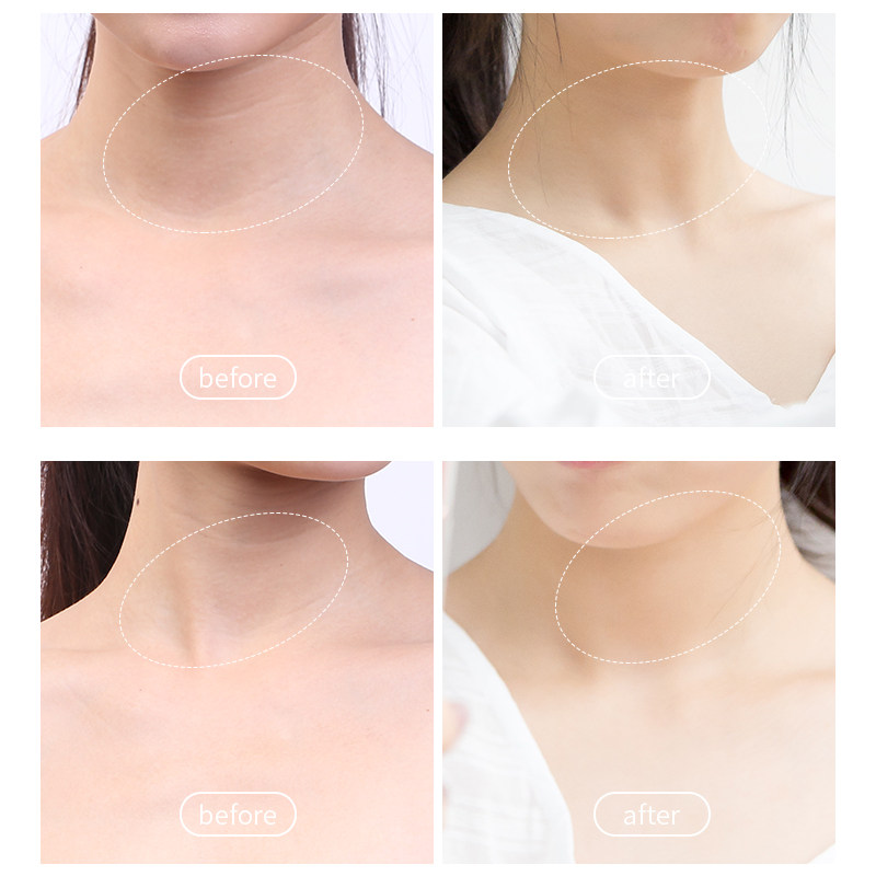 米云双滚轮v型小滚珠按摩密云颈霜 米云化妆品颈霜