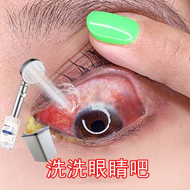眼睛红血丝 新人首单立减十元 21年9月 淘宝海外